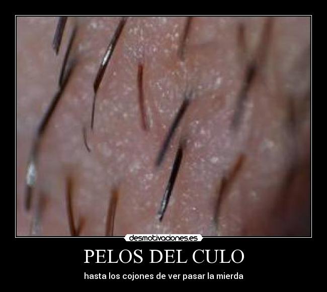 PELOS DEL CULO - 