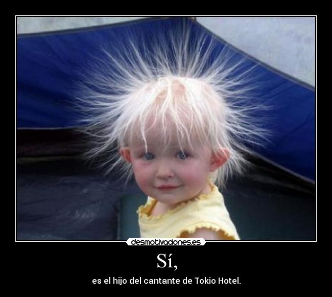 Sí, - es el hijo del cantante de Tokio Hotel.