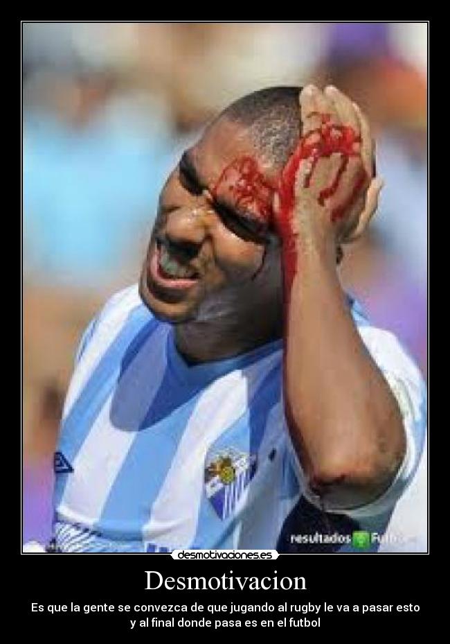 Desmotivacion - Es que la gente se convezca de que jugando al rugby le va a pasar esto
y al final donde pasa es en el futbol