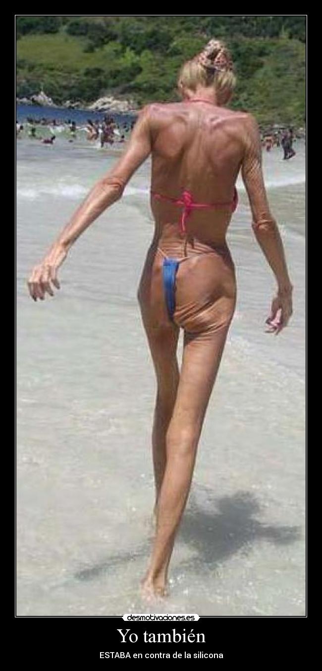 Yo también - ESTABA en contra de la silicona
