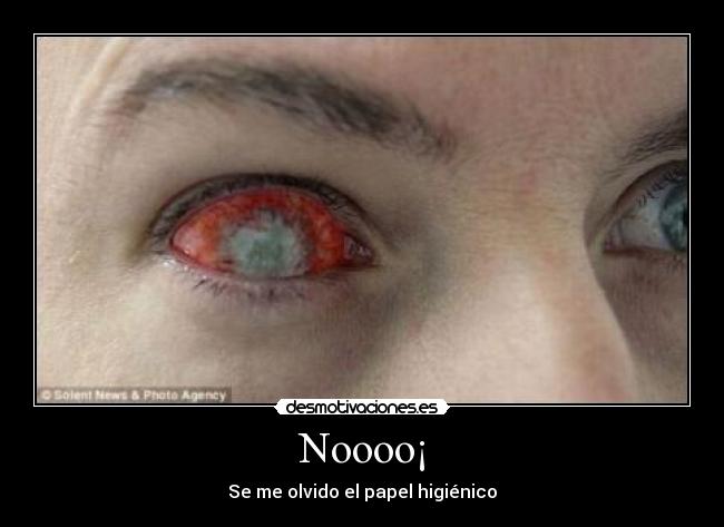 Noooo¡ - 