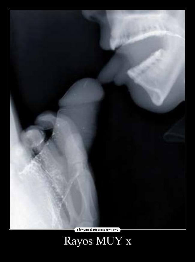 Rayos MUY x - 