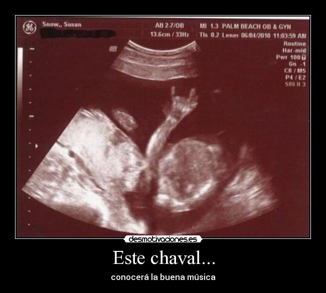 Este chaval... -