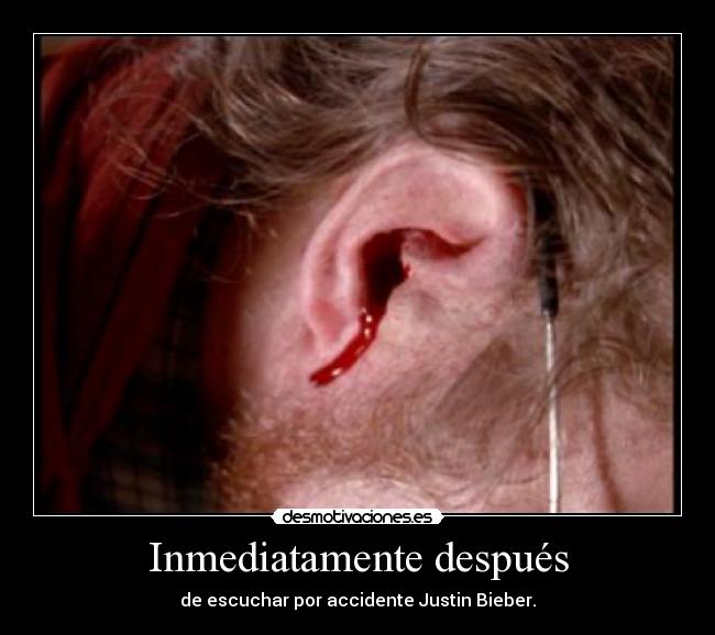 Inmediatamente después - de escuchar por accidente Justin Bieber.