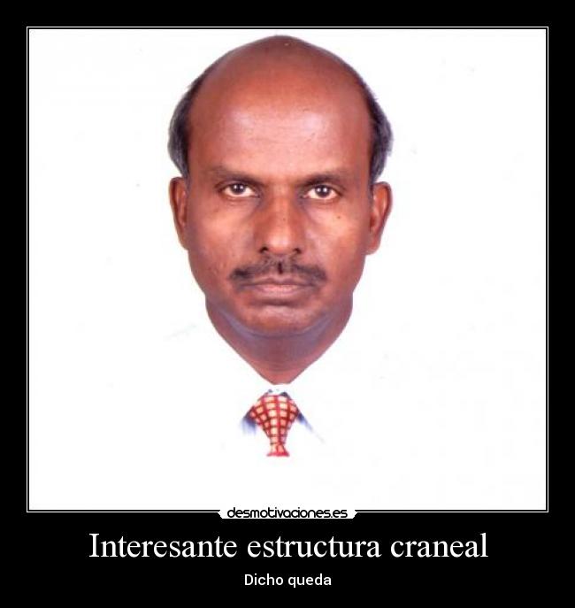 Interesante estructura craneal - Dicho queda