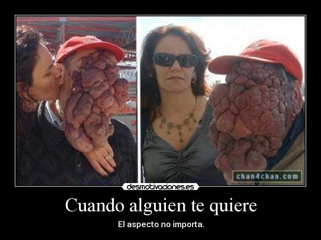 Cuando alguien te quiere - El aspecto no importa.