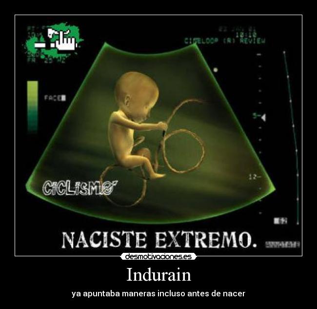Indurain - ya apuntaba maneras incluso antes de nacer