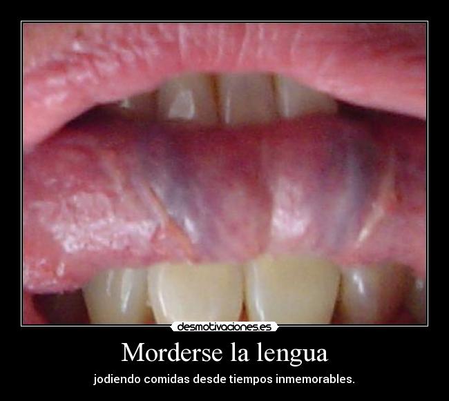 Morderse la lengua - jodiendo comidas desde tiempos inmemorables.