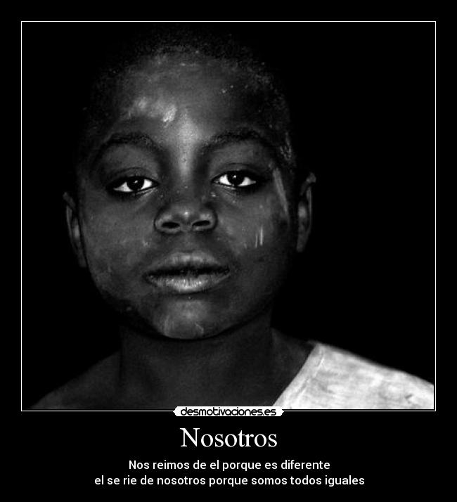 Nosotros - Nos reimos de el porque es diferente
el se rie de nosotros porque somos todos iguales