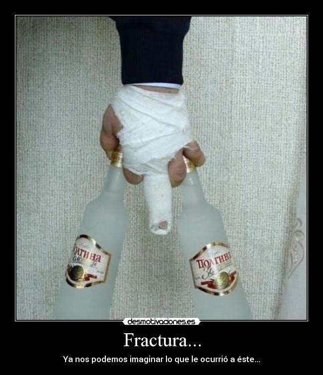 Fractura... - Ya nos podemos imaginar lo que le ocurrió a éste...