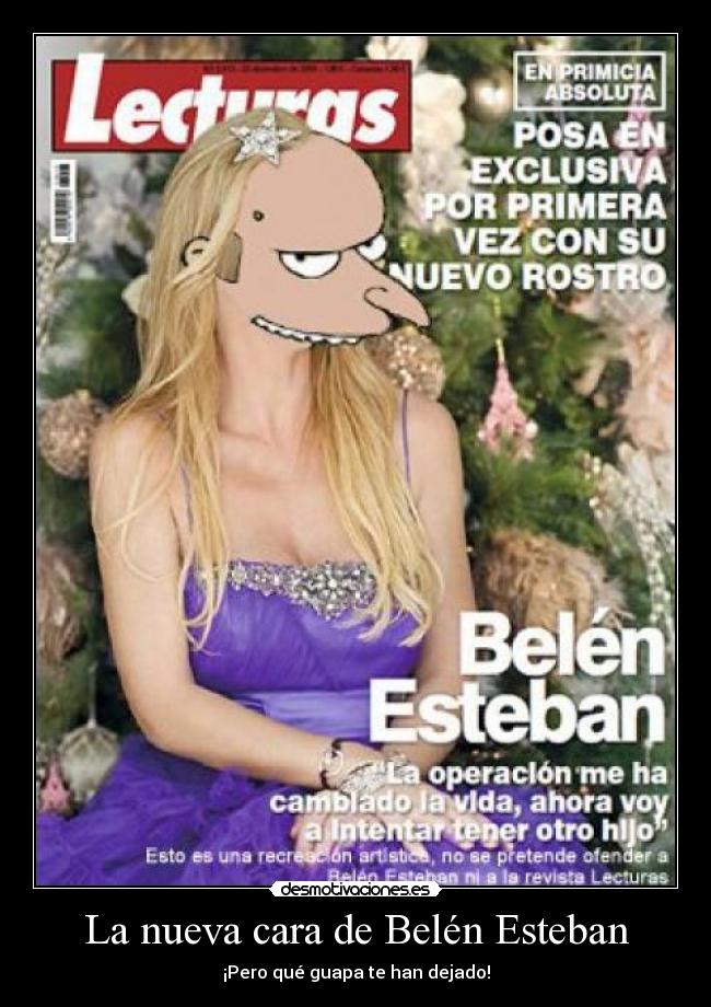 La nueva cara de Belén Esteban -