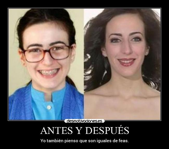 ANTES Y DESPUÉS - 