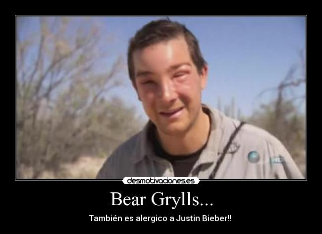 Bear Grylls... - También es alergico a Justin Bieber!!