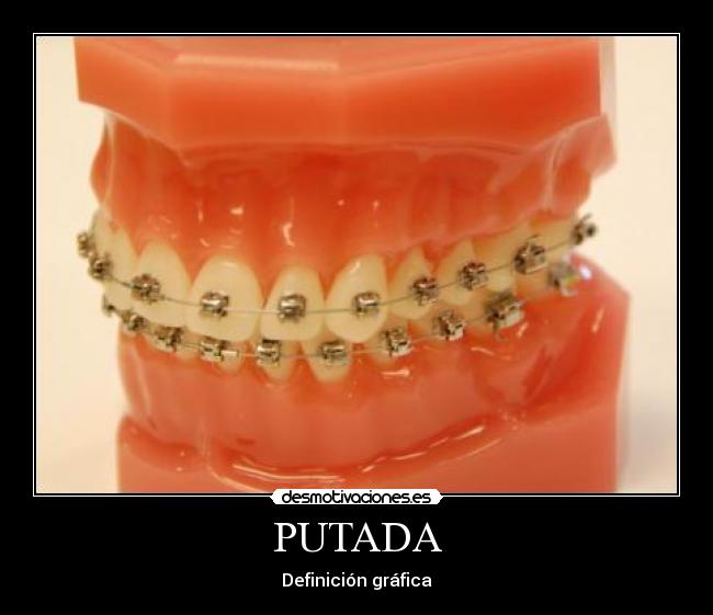 PUTADA - 