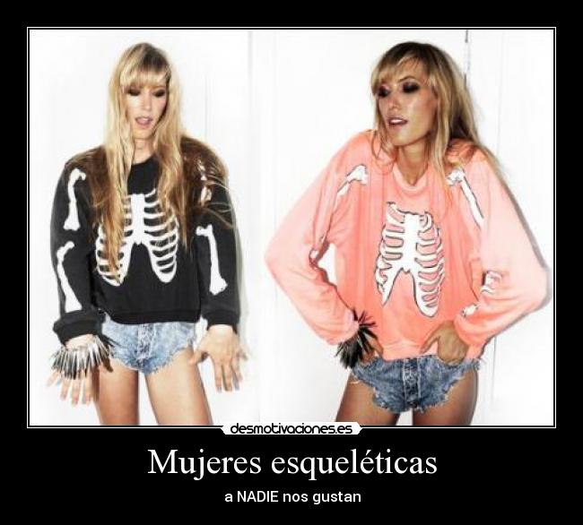 Mujeres esqueléticas - a NADIE nos gustan