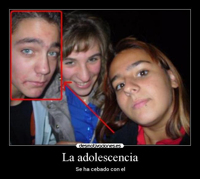 La adolescencia - 