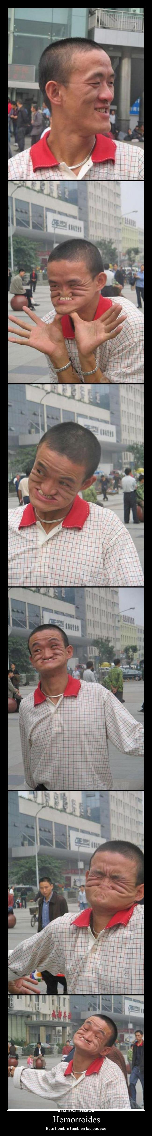 carteles hemorroides desmotivaciones