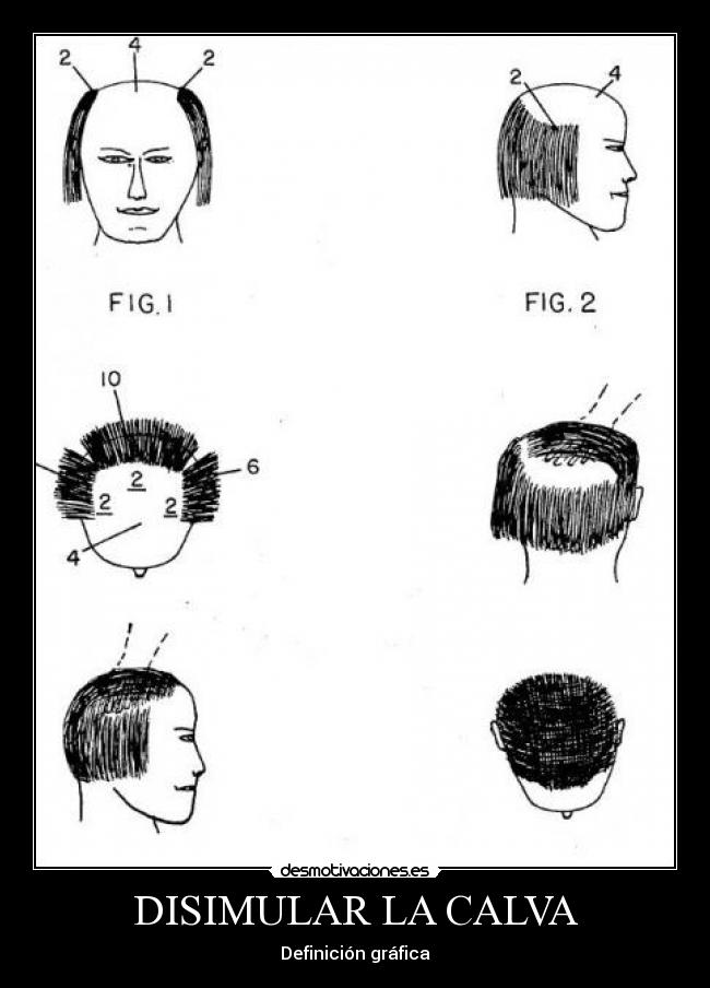 DISIMULAR LA CALVA -