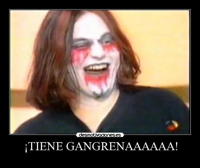 ¡TIENE GANGRENAAAAAA! - 