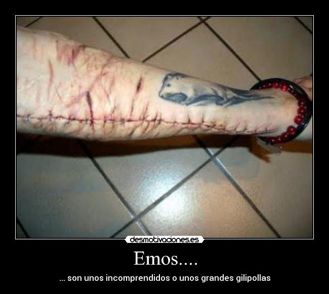 Emos.... -