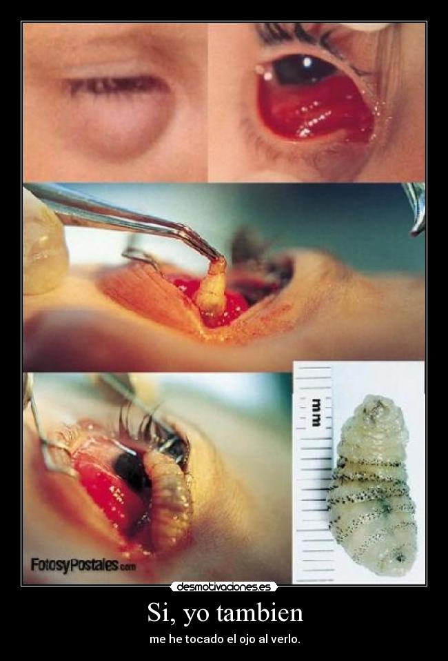 Si, yo tambien - me he tocado el ojo al verlo.