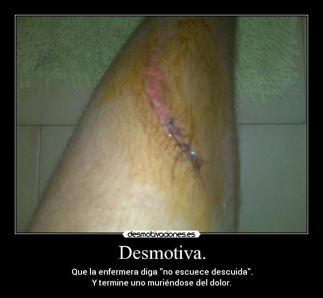 Desmotiva. -