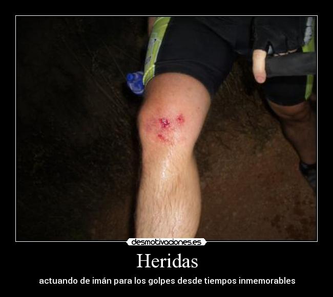 Heridas - actuando de imán para los golpes desde tiempos inmemorables