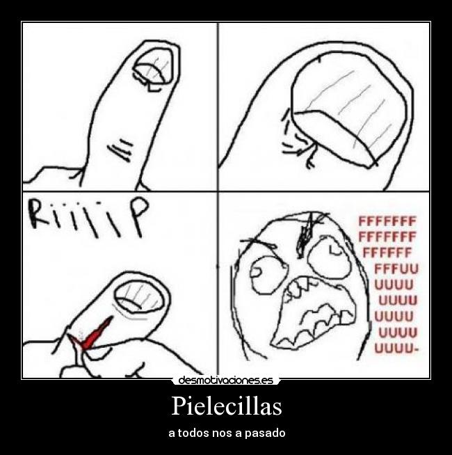 Pielecillas - a todos nos a pasado