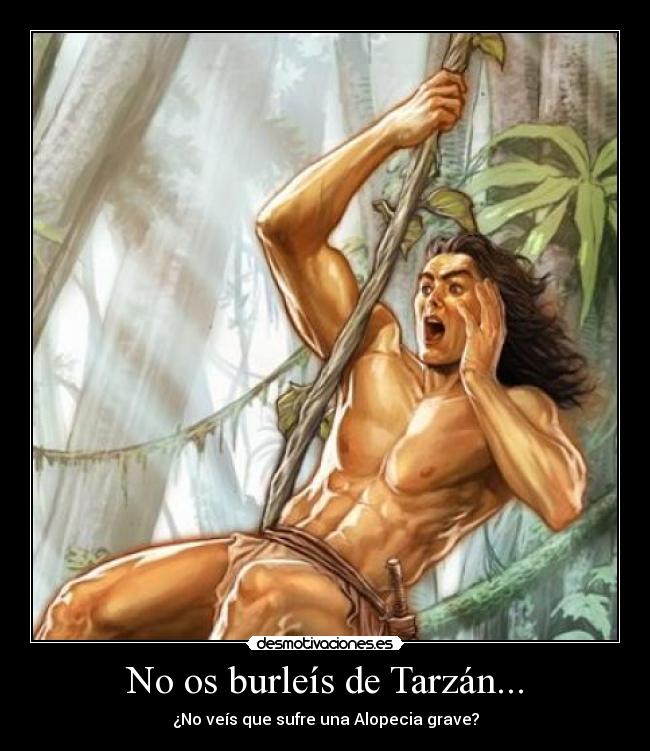 No os burleís de Tarzán... - ¿No veís que sufre una Alopecia grave?