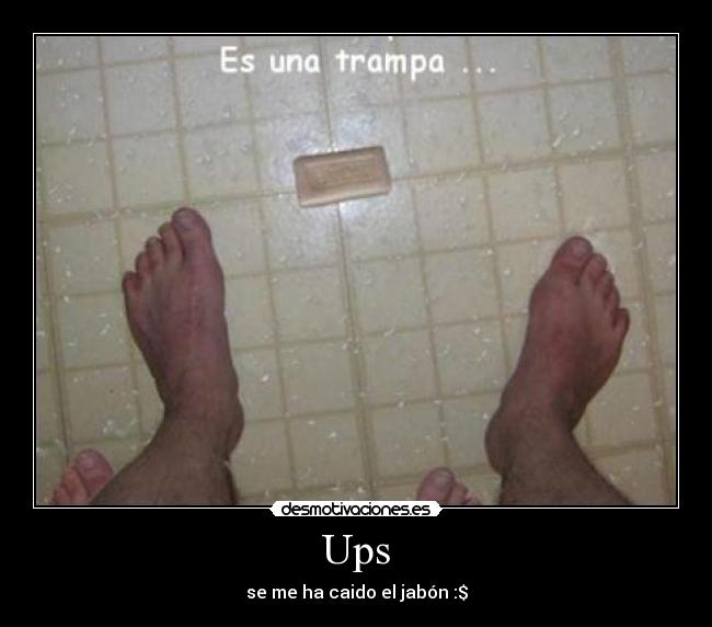 Ups -
