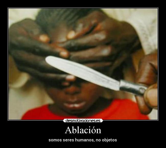 Ablación - 