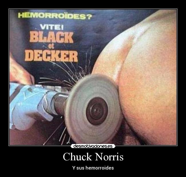 Chuck Norris - Y sus hemorroides