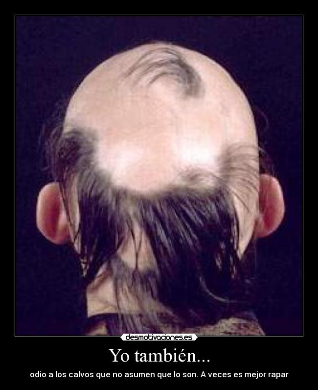 Yo también... -