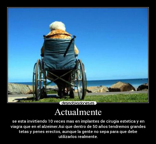 Actualmente - se esta invirtiendo 10 veces mas en implantes de cirugia estetica y en
viagra que en el alzeimer.Asi que dentro de 50 años tendremos grandes
tetas y penes erectos, aunque la gente no sepa para que debe
utilizarlos realmente.
