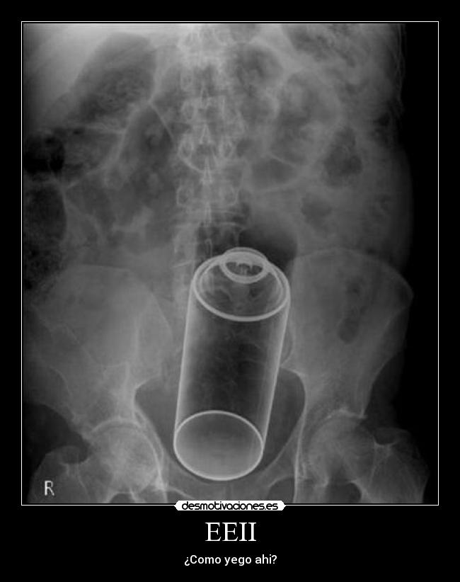 EEII - ¿Como yego ahi?