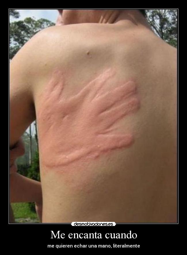 Me encanta cuando - me quieren echar una mano, literalmente