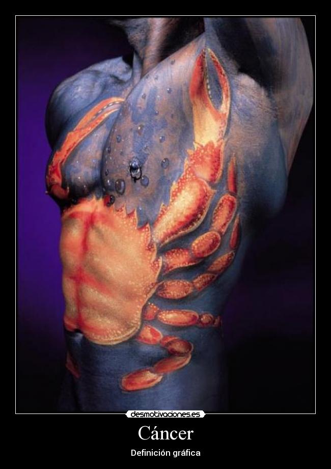 Cáncer - 
