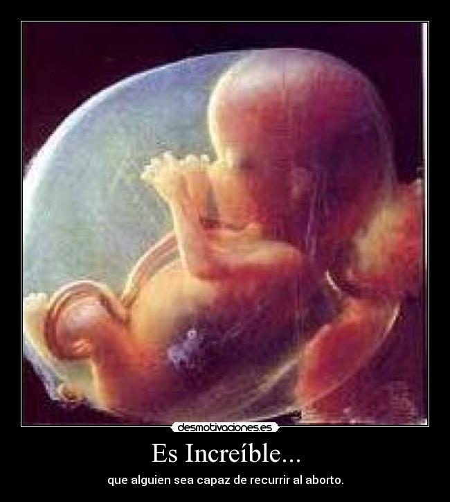 Es Increíble... - que alguien sea capaz de recurrir al aborto.