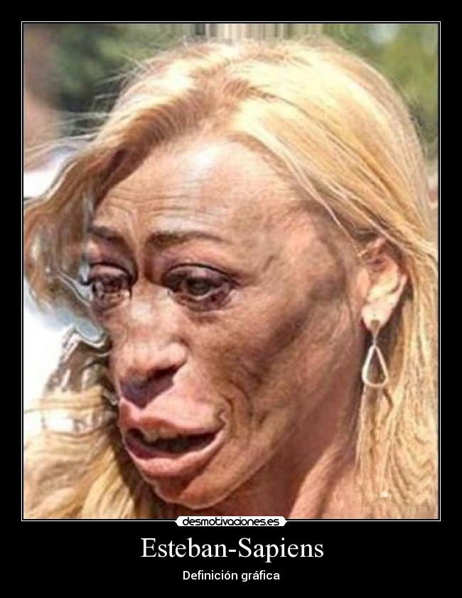 Esteban-Sapiens - 