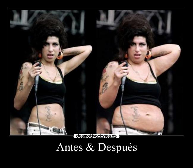Antes & Después -