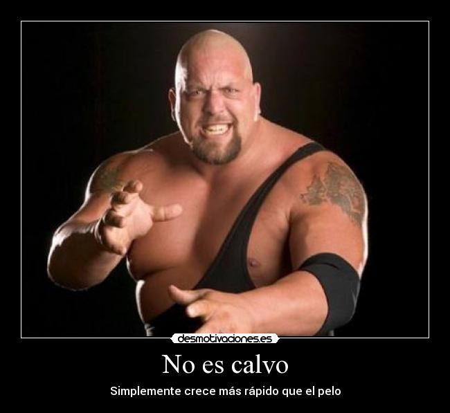 No es calvo - 