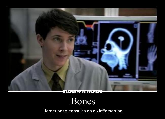 Bones -