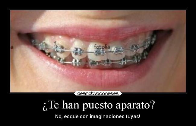 ¿Te han puesto aparato? - No, esque son imaginaciones tuyas!