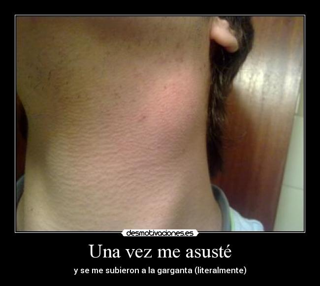 Una vez me asusté -