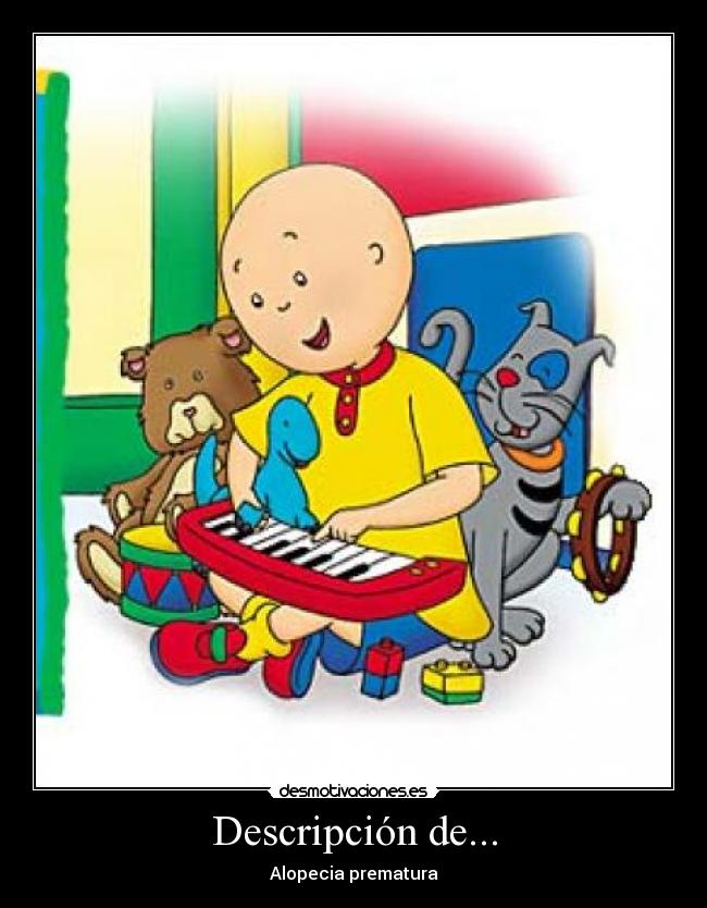 Descripción de... - Alopecia prematura