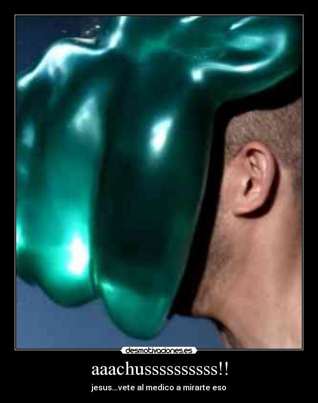 aaachussssssssss!! - 