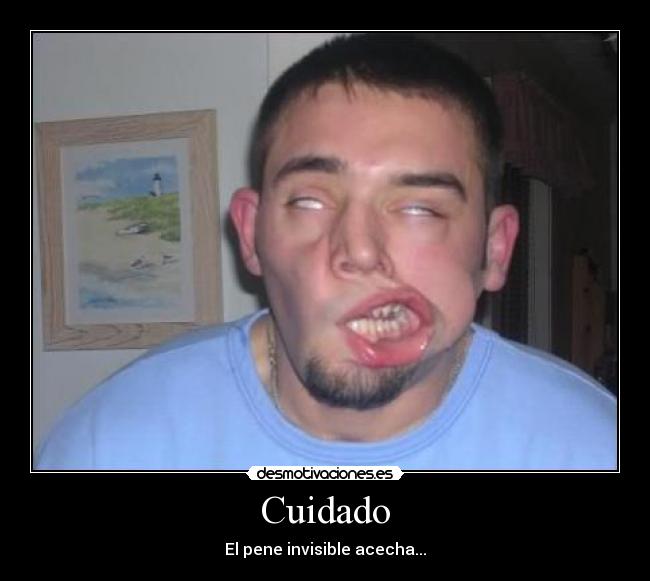 Cuidado -
