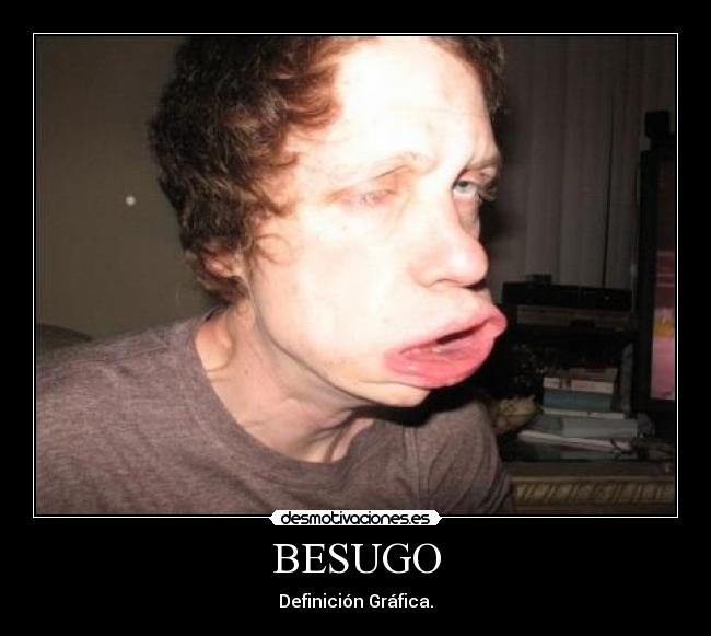 BESUGO - Definición Gráfica.