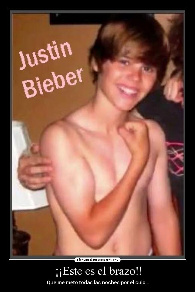 ¡¡Este es el brazo!! -