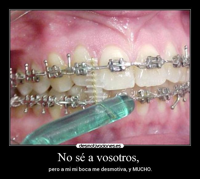 No sé a vosotros, - pero a mi mi boca me desmotiva, y MUCHO.